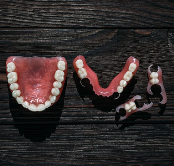 Partial dentures replacing missing teeth