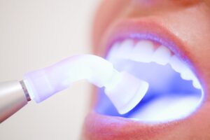 soft tissue laser inside a patient's mouth